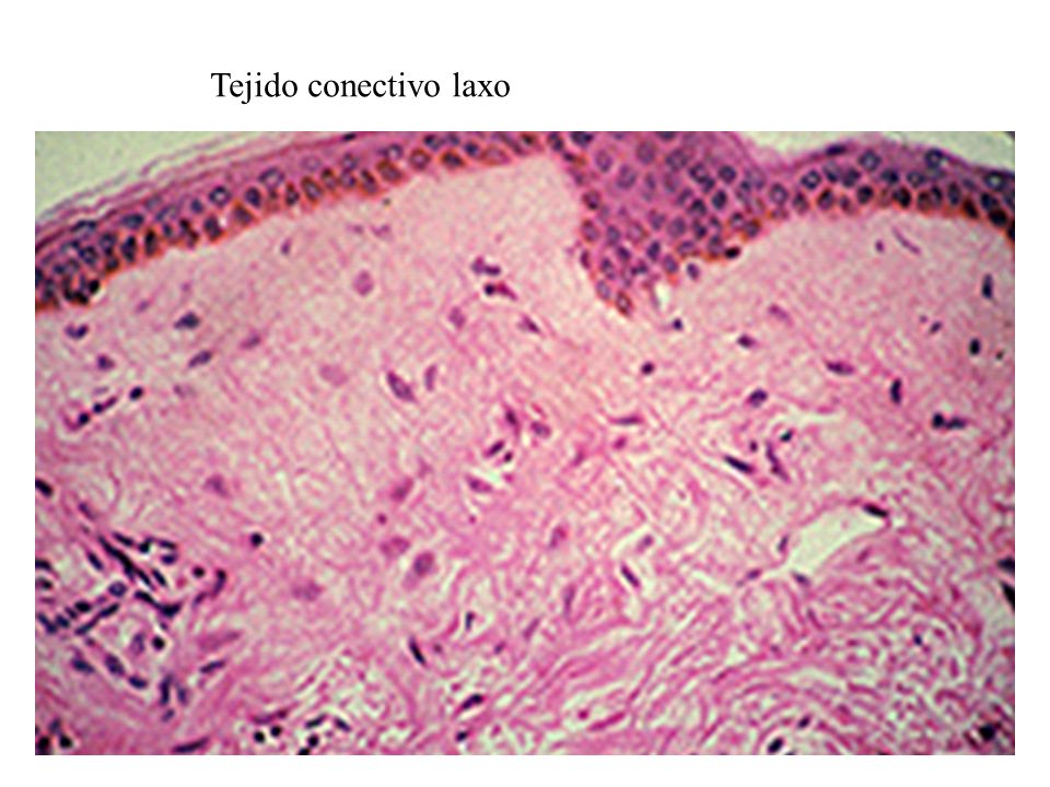 TEJIDO CONECTIVO LAXO tejido conectivo laxo: