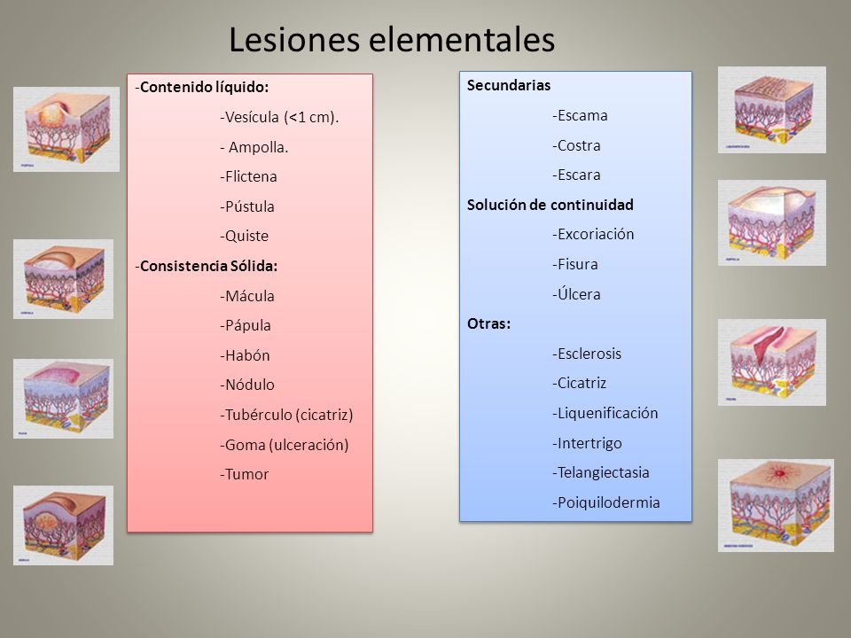 LESIONES ELEMENTALES EN LA PIEL lesiones elementales en la piel: