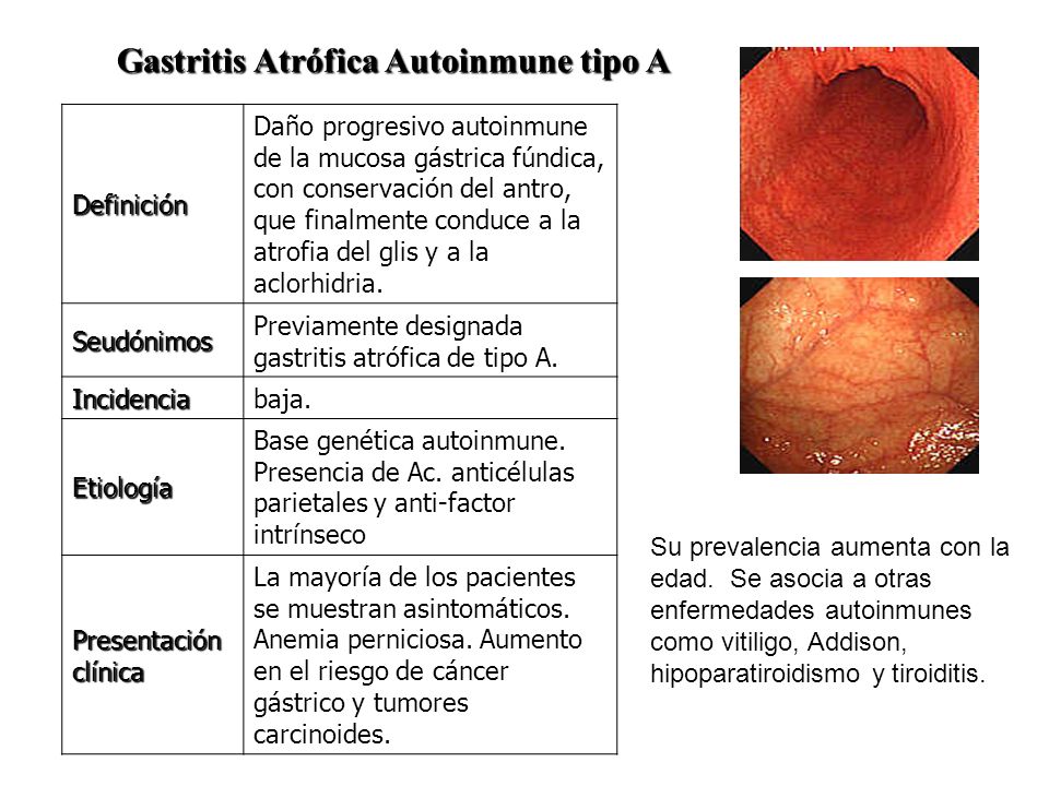 GASTRITIS DEFINICION gastritis definicion: