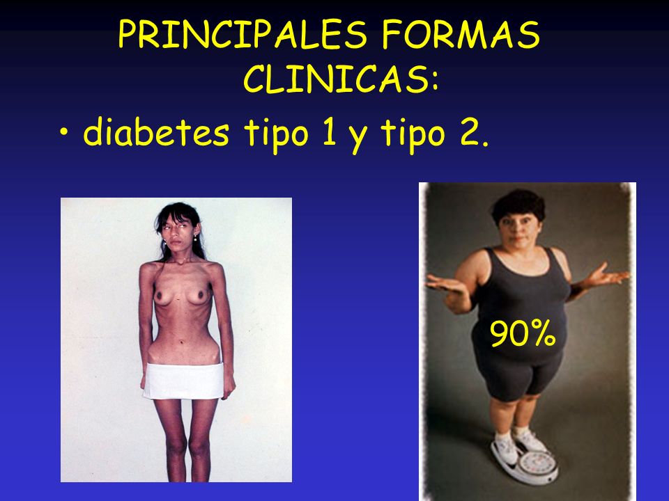 LAS PRINCIPALES EPIDEMIAS las principales epidemias: