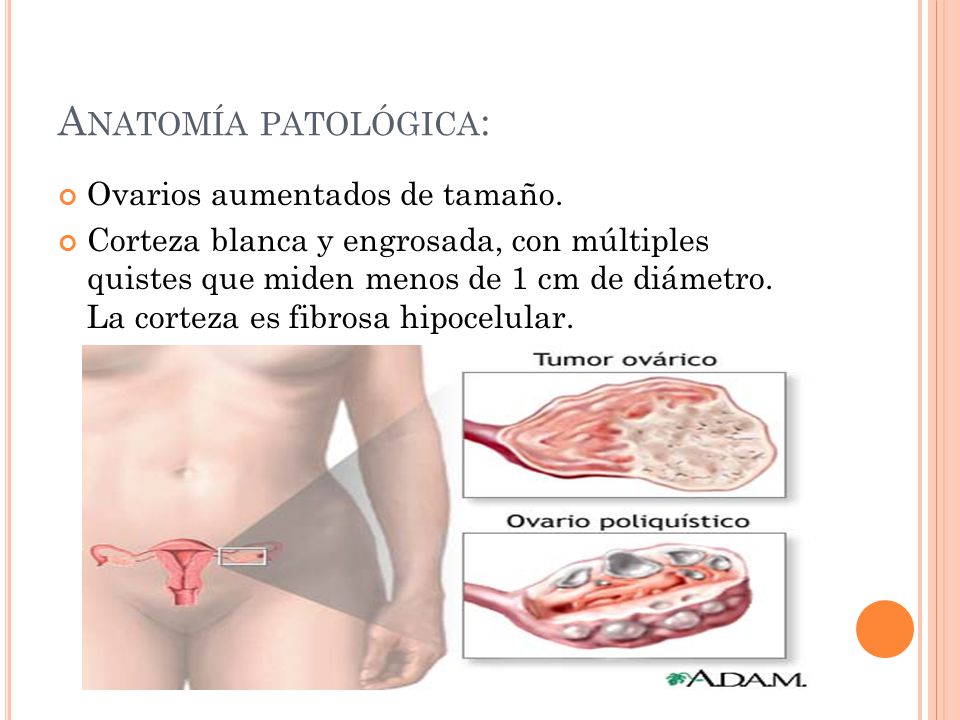 levaquin weight loss levaquin weight loss
