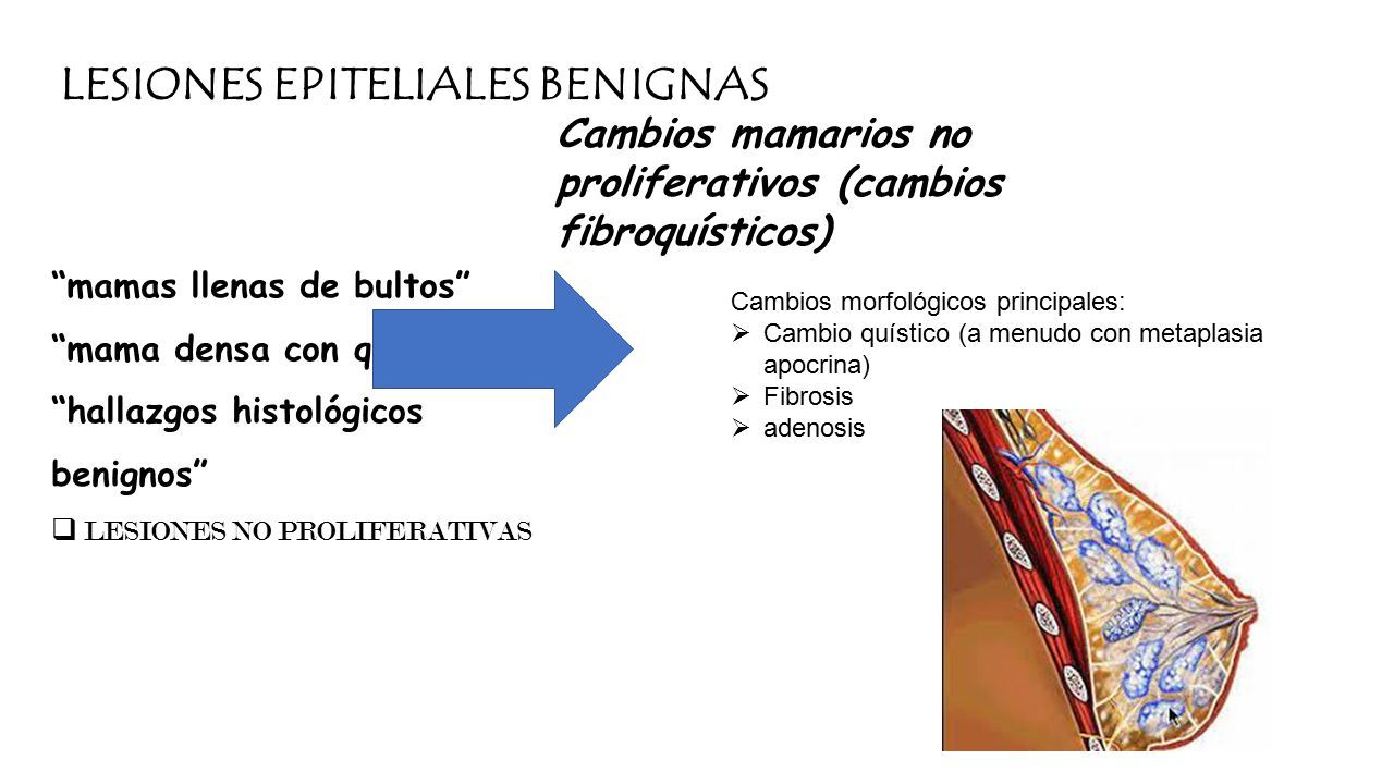 Trastornos Inflamatorios De Los S Ntomas Mamarios Infecciones