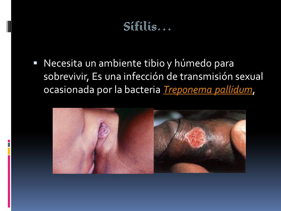 Sífilis…  Necesita un ambiente tibio y húmedo para sobrevivir, Es una infección de transmisión sexual ocasionada por la bacteria Treponema pallidum,Treponema pallidum