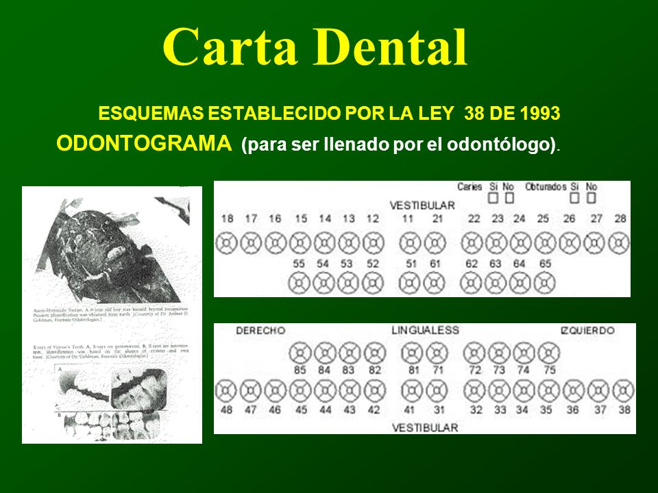 13 DE LA LEY 38 2003 DE 13 de la ley 38 2003 de: