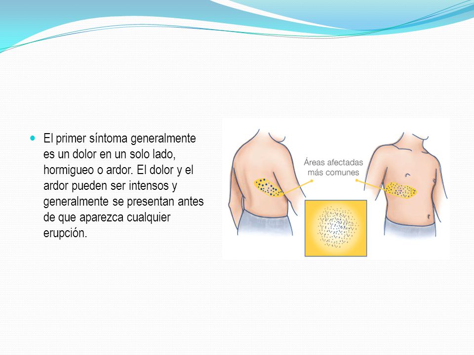 HORMIGUEO PECHO hormigueo pecho: