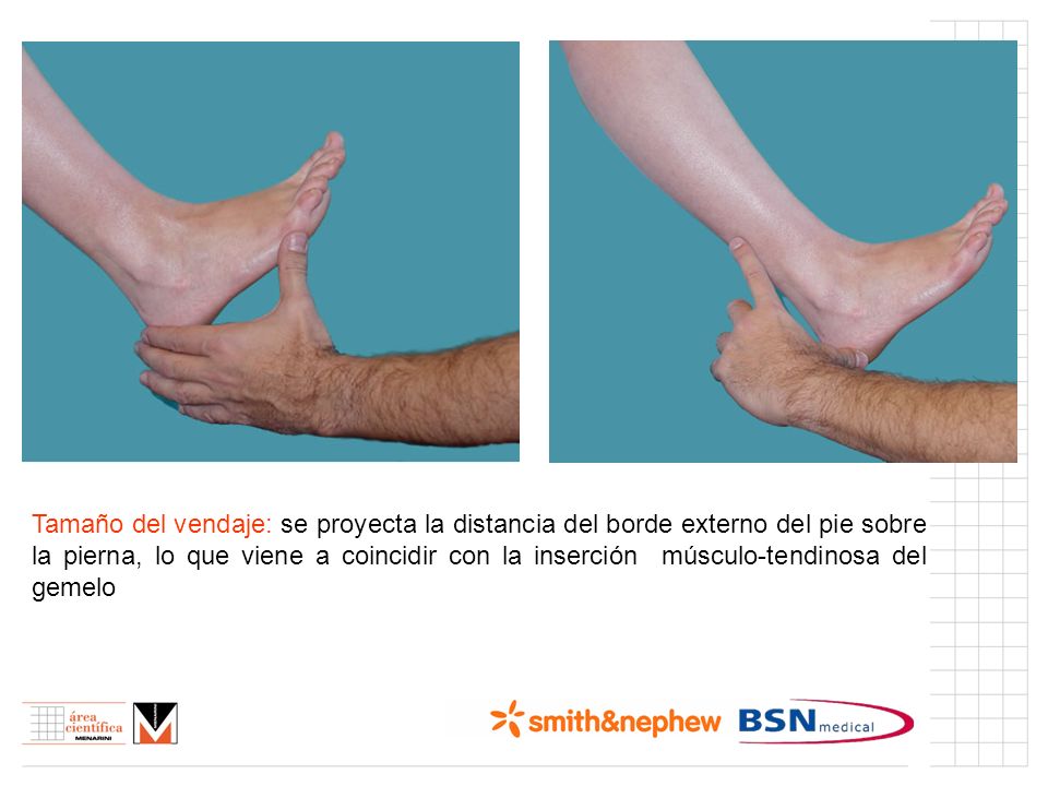 VENDAJE ESGUINCE TOBILLO vendaje esguince tobillo: