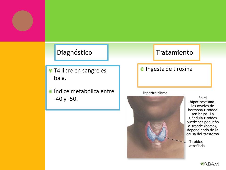 Diagnóstico T4 libre en sangre es baja. Índice metabólica entre -40 y -50