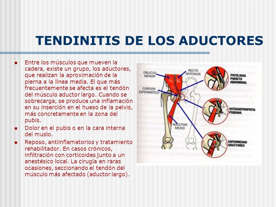 LESIONES EN LOS ADUCTORES lesiones en los aductores:
