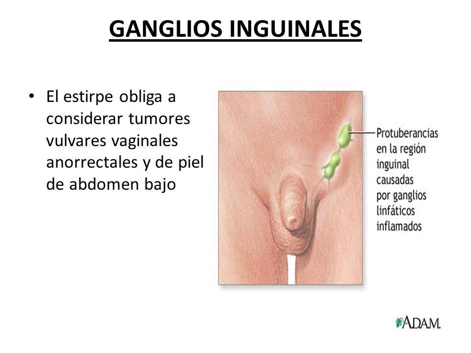 GANGLIOS INGUINALES ganglios inguinales:
