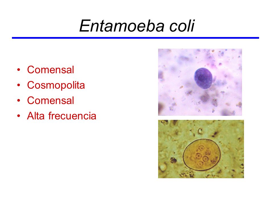 Generalidades De Protozoarios Y Amebas C Lula Eucariota Vs C Lula