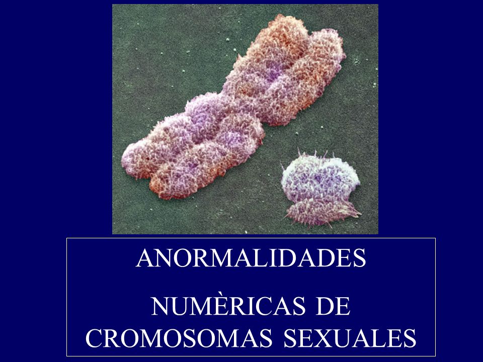ANORMALIDADES NUMÈRICAS DE CROMOSOMAS SEXUALES