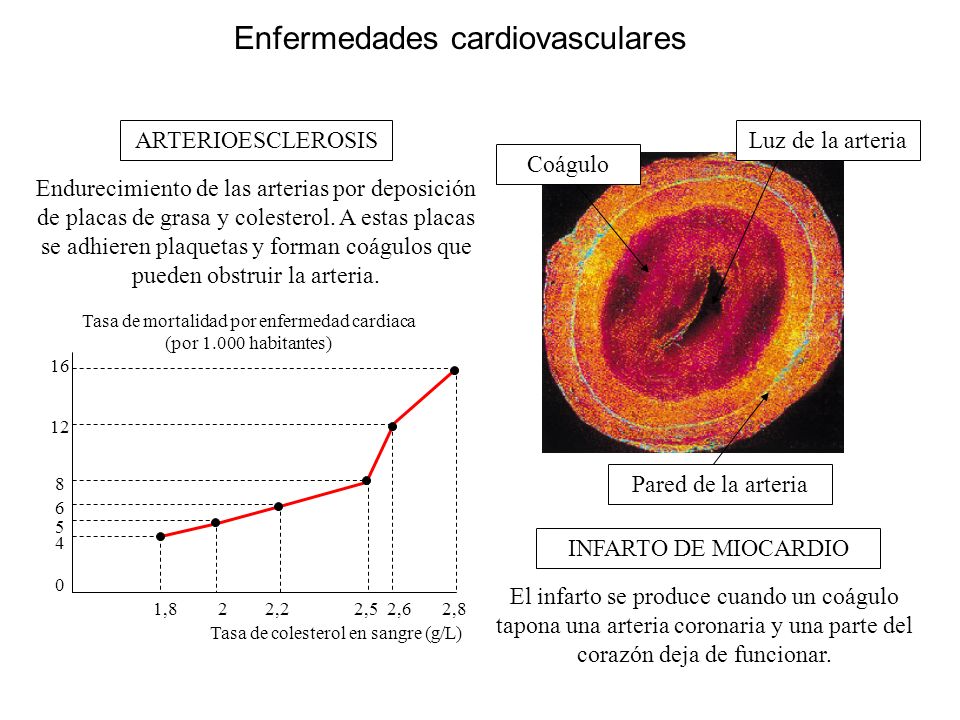 Enfermedades cardiovasculares Tasa de mortalidad por enfermedad cardiaca (por habitantes) Tasa de colesterol en sangre (g/L) ,8 2 2,2 2,5 2,6 2,8 Luz de la arteria Coágulo Pared de la arteria ARTERIOESCLEROSIS INFARTO DE MIOCARDIO Endurecimiento de las arterias por deposición de placas de grasa y colesterol.