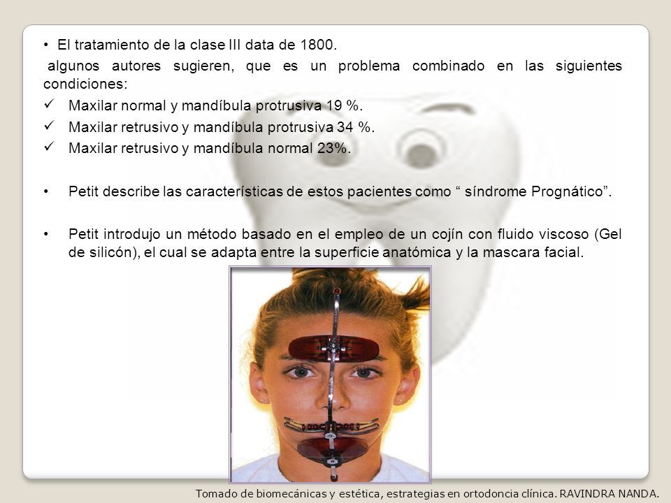 Partes de la máscara facial