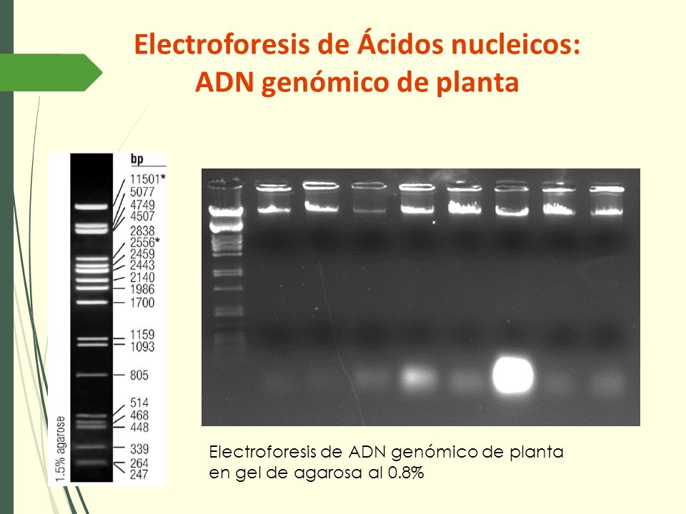 Electroforesis De Los ácidos Nucleicos Electroforesis De Ácidos Nucleicos Arn Electroforesis 4975