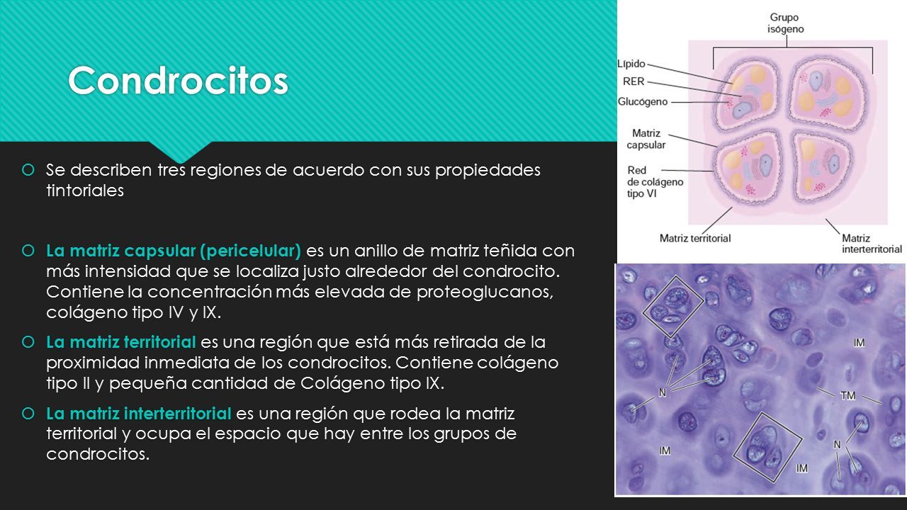 TEJIDO CARTILAGINOSO Histología I – UNIDA - CDE. Generalidades Es un ...