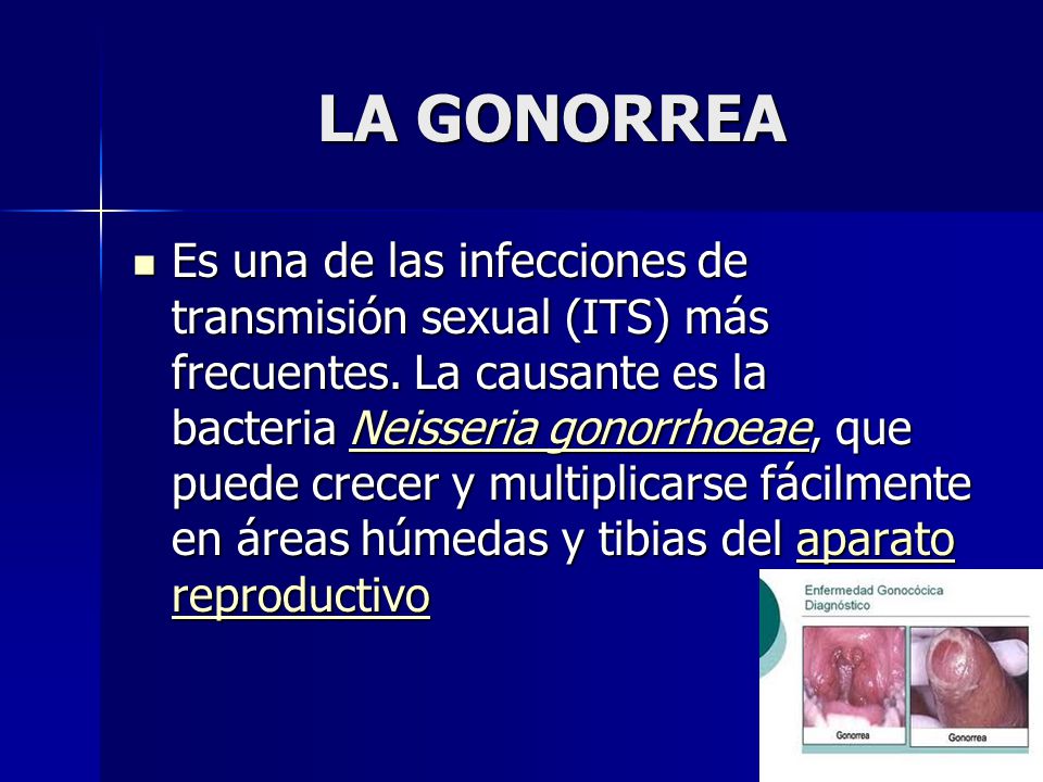 LA GONORREA Es una de las infecciones de transmisión sexual (ITS) más frecuentes.