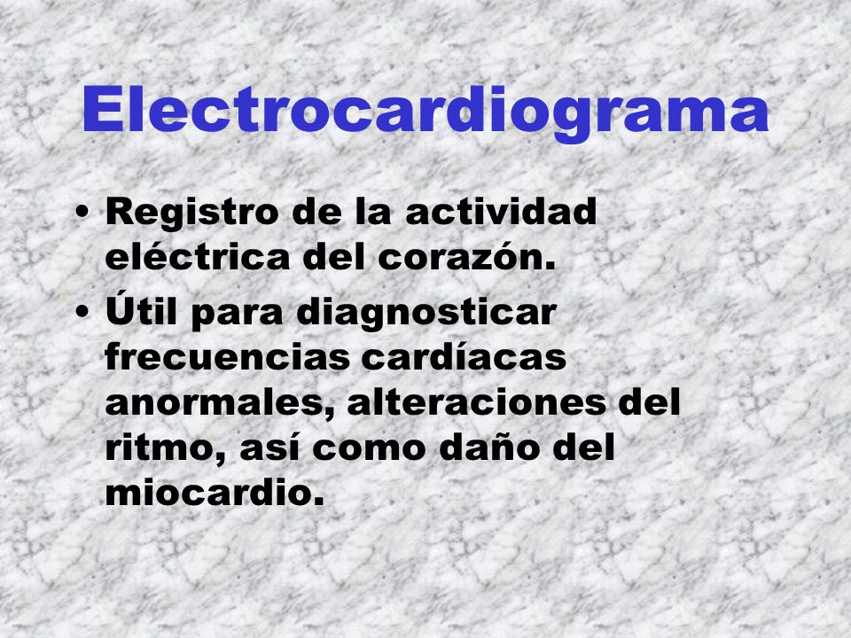Electrocardiograma Registro de la actividad eléctrica del corazón.