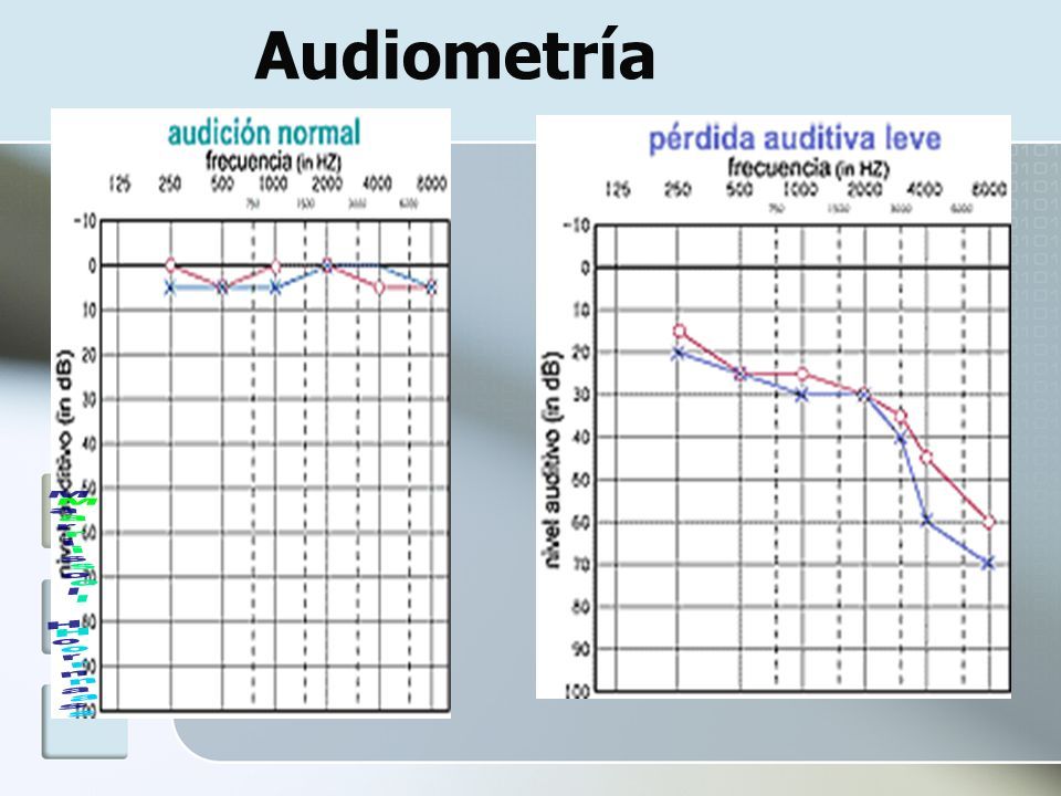 Audiometría Audiograma AudiÓmetro Audiometría Grado De Pérdida Auditiva Ppt Descargar 1791