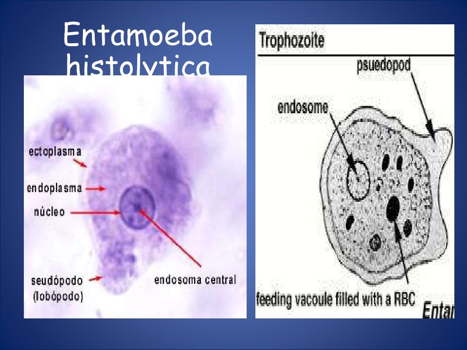 CasificaciÓn TaxonÓmica Entamoeba Histolytica Amebiasis Intestinal Y Extraintestinal Amebiasis 0125