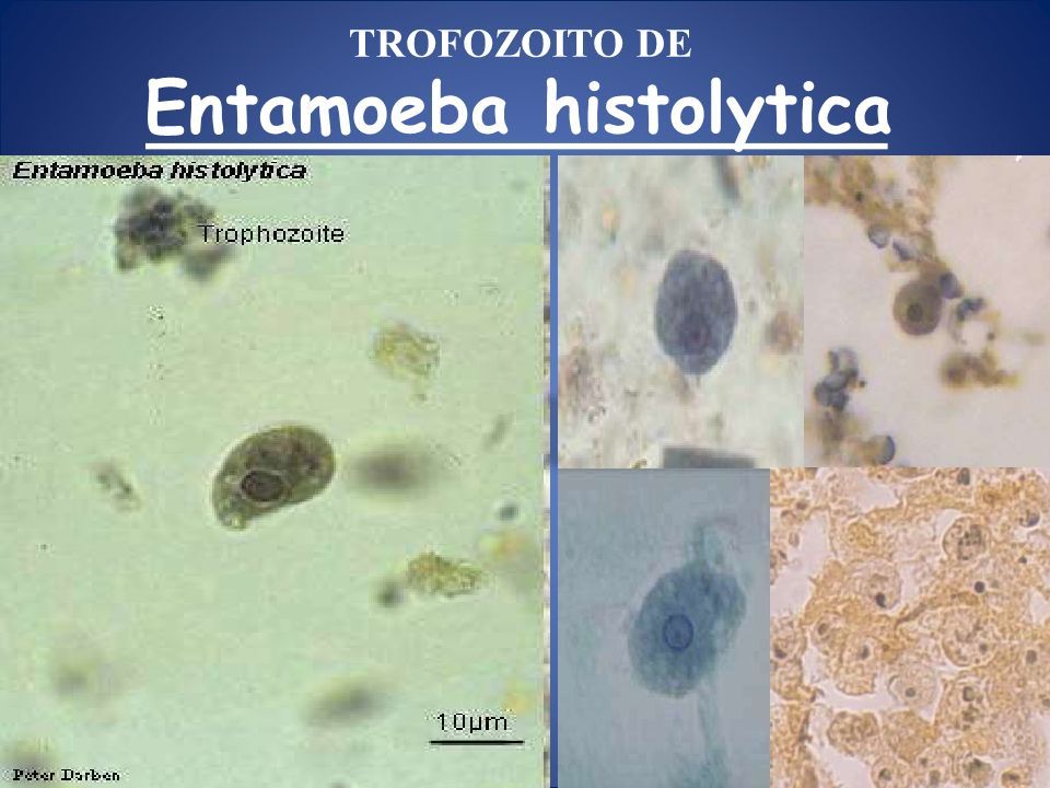 CasificaciÓn TaxonÓmica Entamoeba Histolytica Amebiasis Intestinal Y Extraintestinal Amebiasis 2775