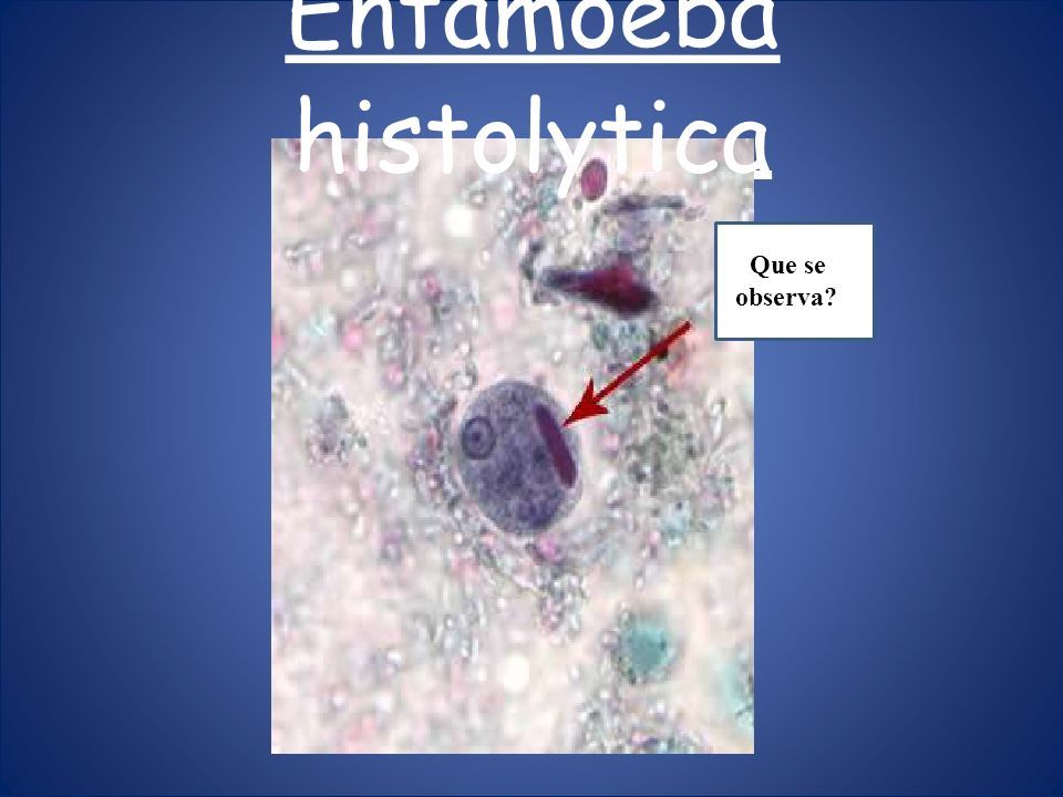 CasificaciÓn TaxonÓmica Entamoeba Histolytica Amebiasis Intestinal Y Extraintestinal Amebiasis 1051