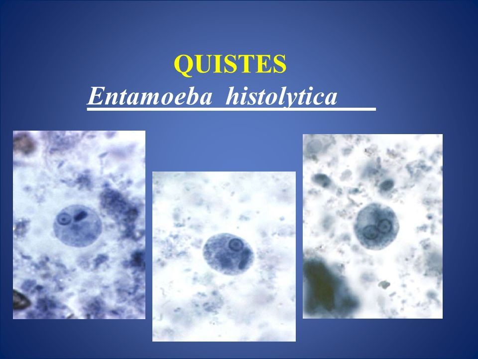 CasificaciÓn TaxonÓmica Entamoeba Histolytica Amebiasis Intestinal Y Extraintestinal Amebiasis 6907