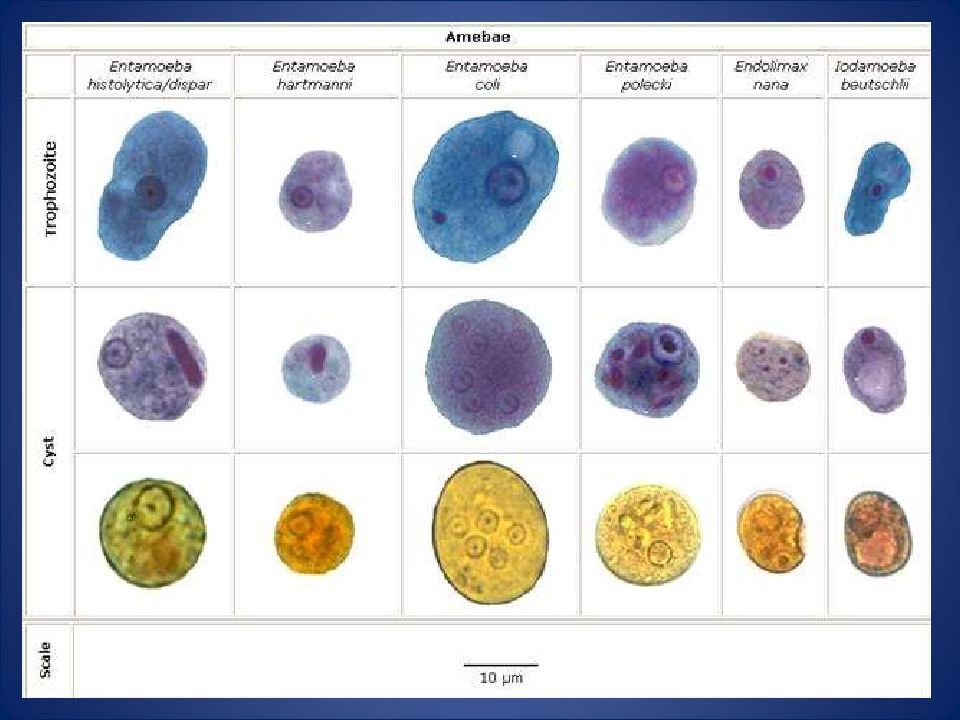 CasificaciÓn TaxonÓmica Entamoeba Histolytica Amebiasis Intestinal Y Extraintestinal Amebiasis 7181