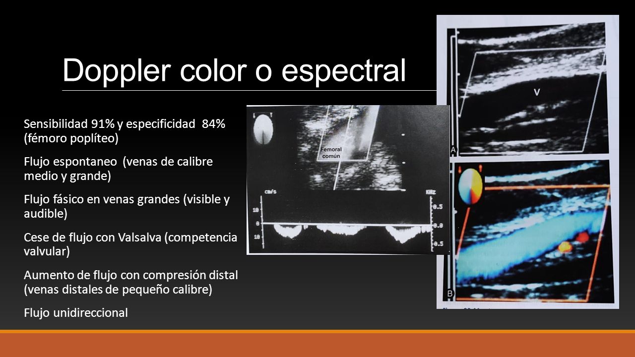 Contenidos Anatomía Venosa Del Miembro Inferiortécnica Doppler De