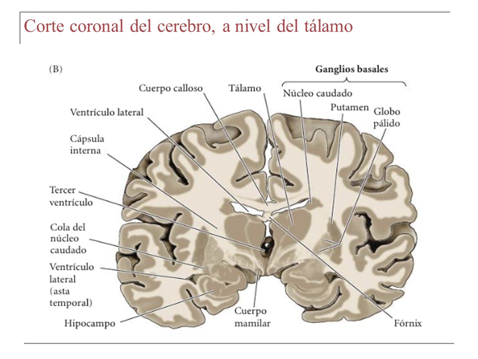 fórnix cerebro coronal