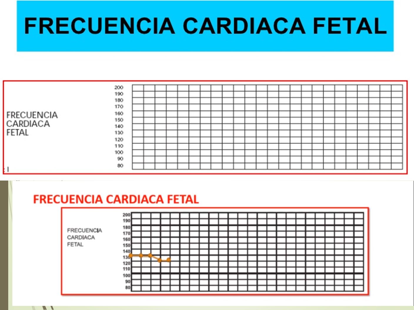 Partograma Oms Modificado GuÍa De UtilizaciÓn Dra Karen Monica Quispe Pelaez Ppt Descargar 4393