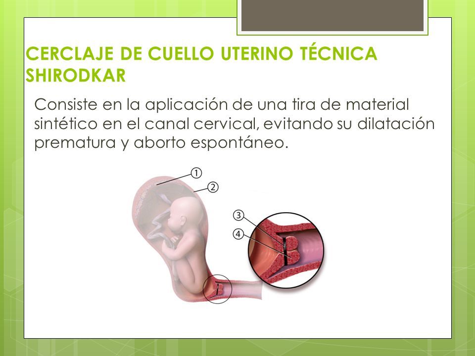 Materia Enfermeria Quirurgica Ii Maestra Eeqx Soraya Jacqueline Morales CastaÑon Trabajo 7408