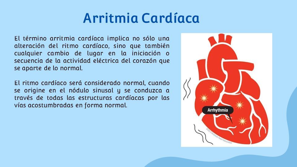 Clasificación De Antiarritmicos Cardiología I Dr. Everardo Santana De ...