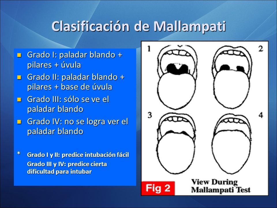 INTUBACIÓN ENDOTRAQUEAL. Intubación Endotraqueal Consiste en la ...