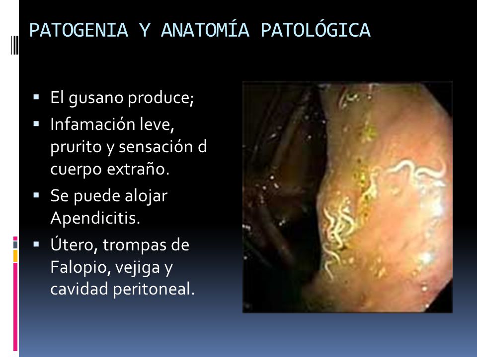 Enterobiasis vagy enterobius. 120 nap alatt a bél körül