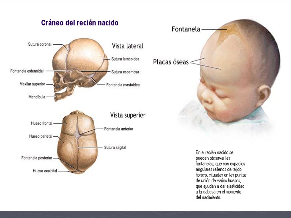 Cetosis recien nacido