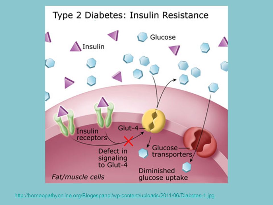 Resistencia insulina adelgazar