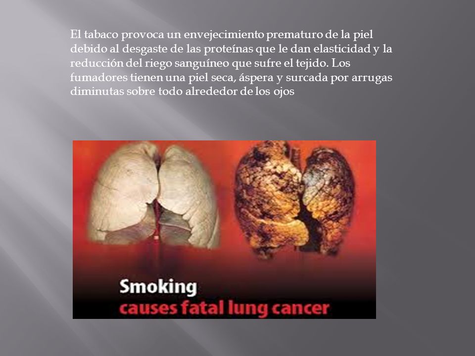 El tabaco provoca un envejecimiento prematuro de la piel debido al desgaste de las proteínas que le dan elasticidad y la reducción del riego sanguíneo que sufre el tejido.
