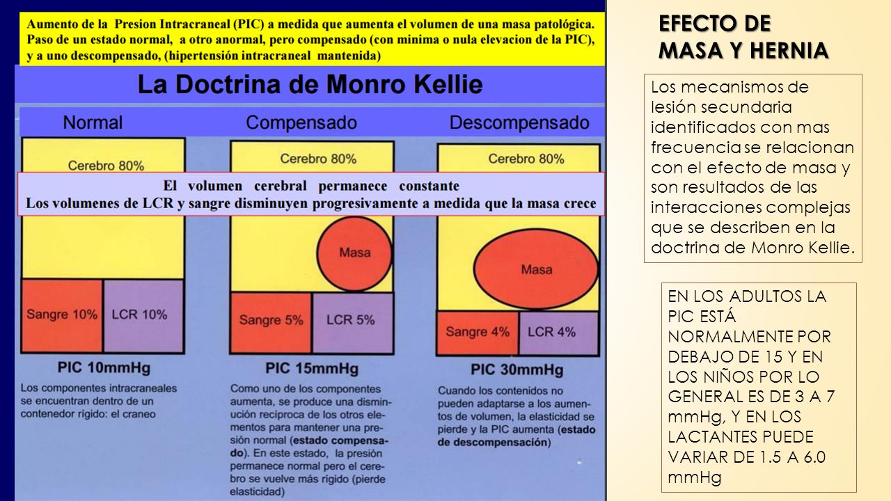 la doctrina de monro kellie