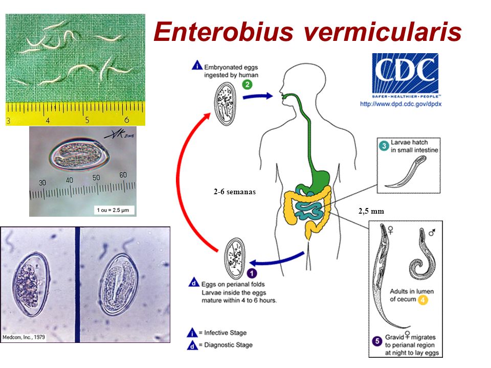 Энтеробиоз возбудитель рисунок