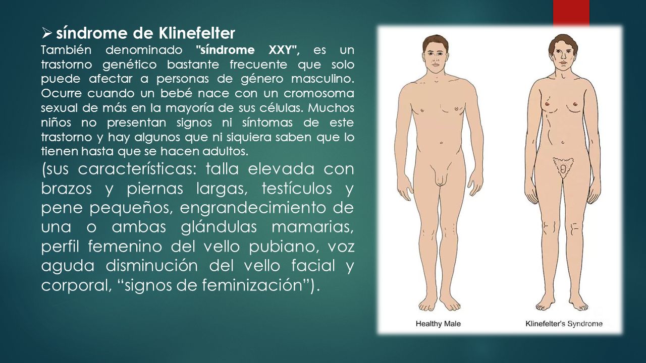 Síndrome de alejandría wikipedia