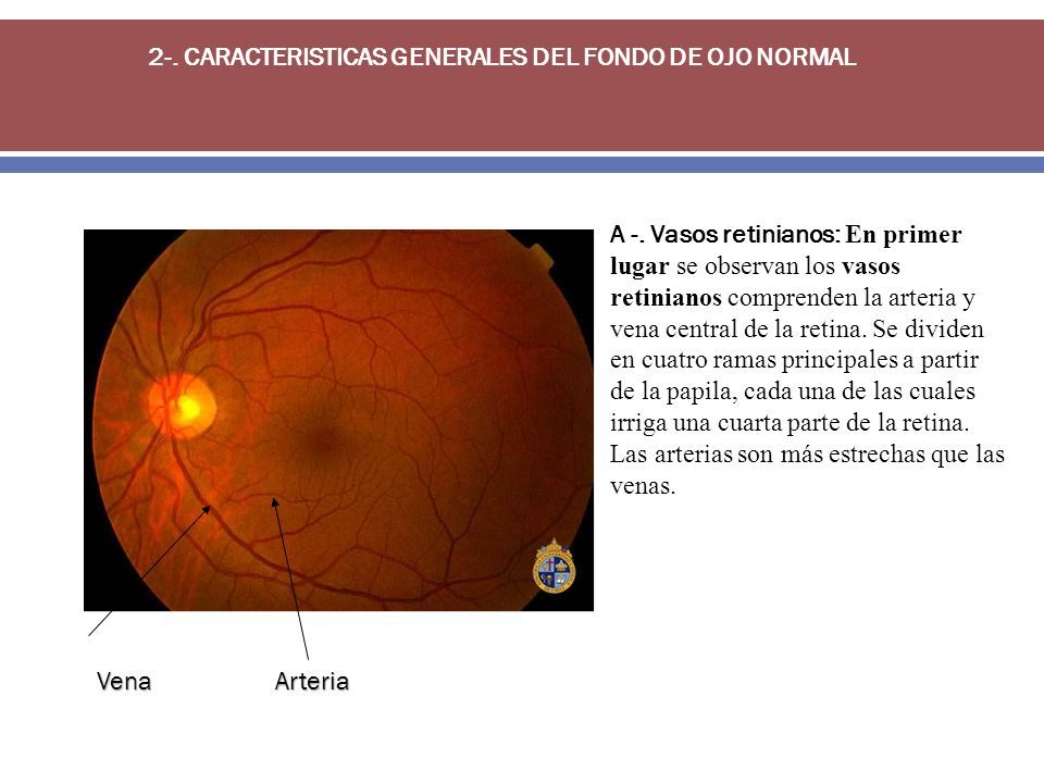 Realizamos oftalmoscopia directa, revisando las estructuras internas del ojo,  esto nos permite detectar cuando hay, enfermedades oculares o sistémicas, -  ppt descargar