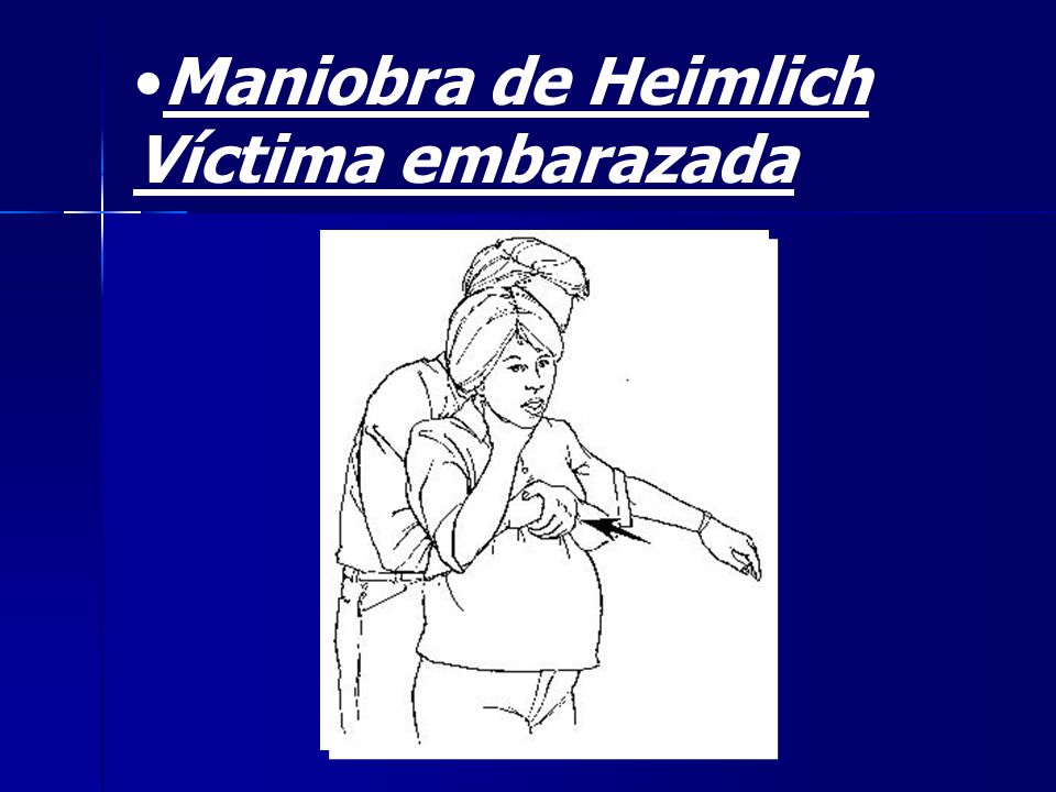 Maniobra de Heimlich Víctima embarazada