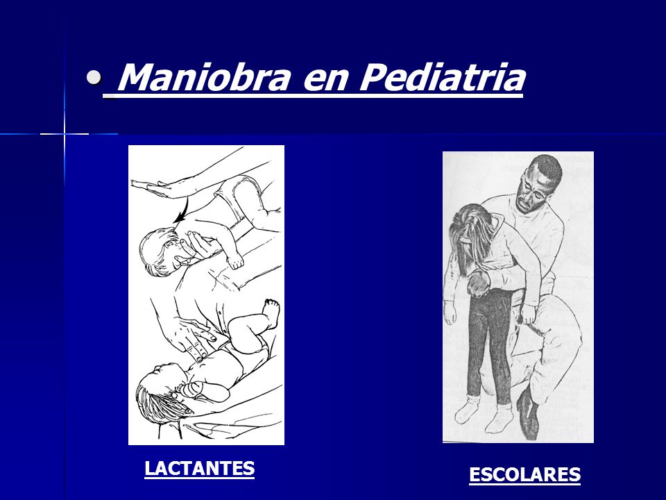 Maniobra en Pediatria LACTANTES ESCOLARES