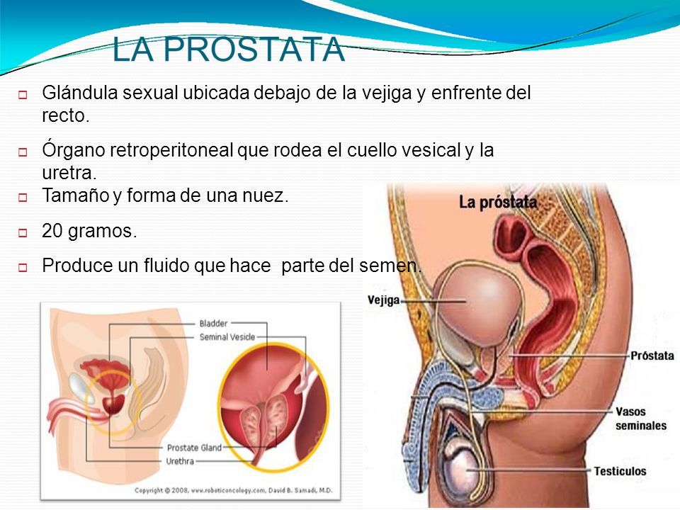 cáncer de próstata cuidados de enfermería)