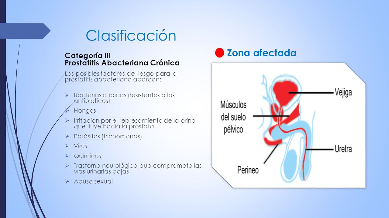 prostatitis cronica ppt)