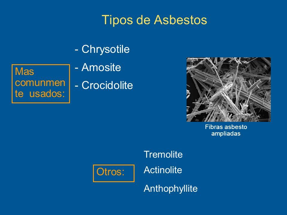 Tipos de asbestosis