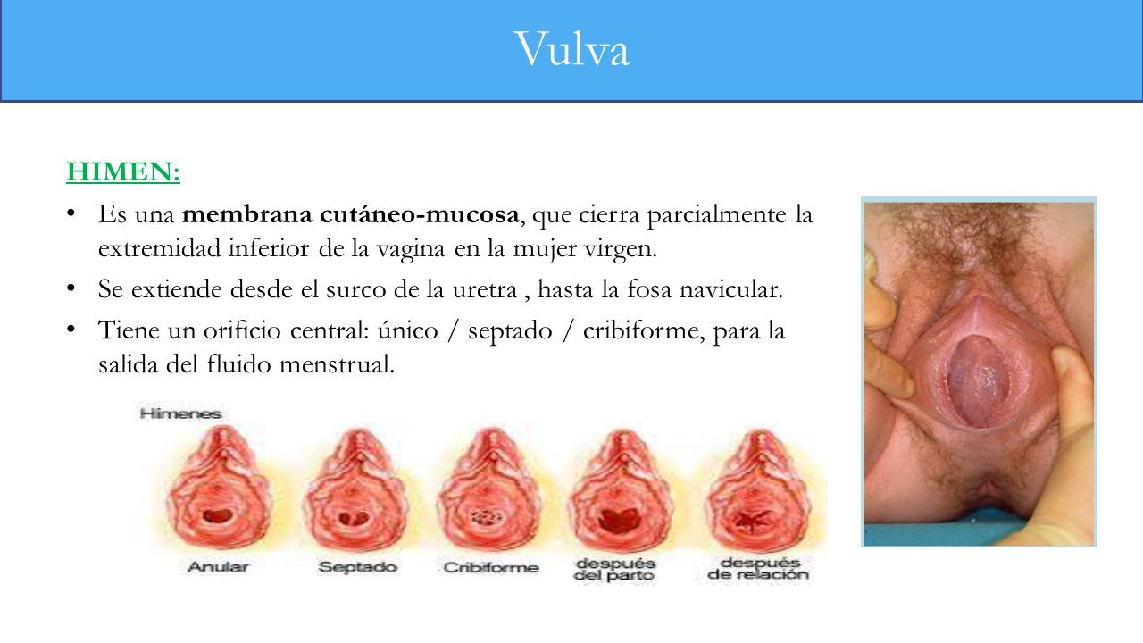 Se te puede reconstruir el himen de forma natural