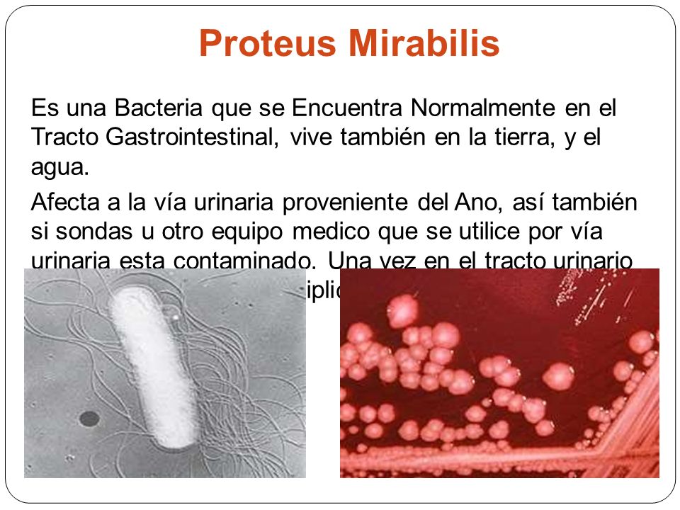 Proteus mirabilis что это такое. Протеус вульгарис заболевание. Протеус бактерия заболевания.