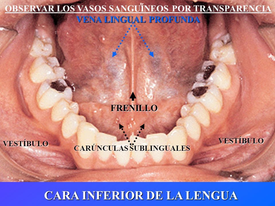 Vísceras de Cabeza y Cuello APARATO DIGESTIVO CAVIDAD ORAL Lengua ...