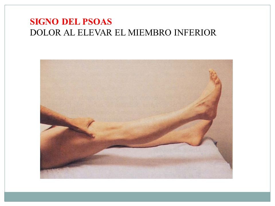 signo del psoas